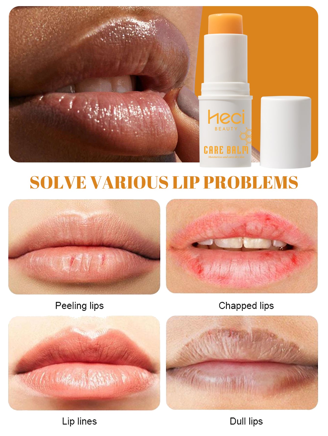 Lip Balm